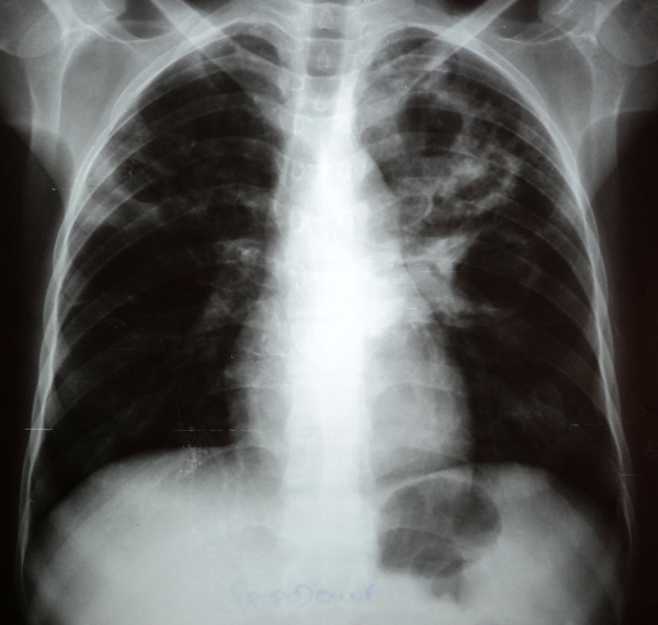 cas clinique 1