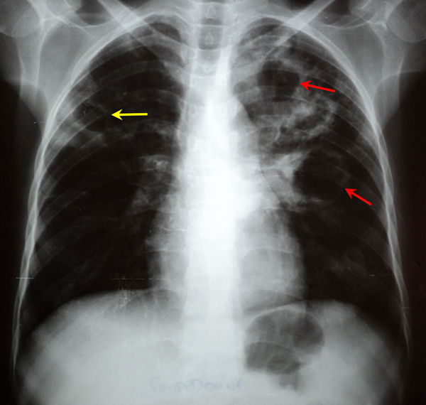 cas clinique 1